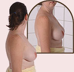 Turn from side to side.  Check the side of each breast.