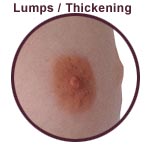 Lumps / Thickening