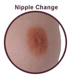 Nipple Change