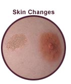 Skin Changes